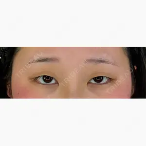 アリエル美容クリニック 郡山院口コミ