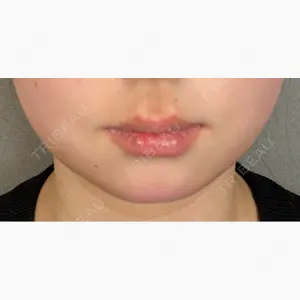 アリエル美容クリニック 大宮院口コミ