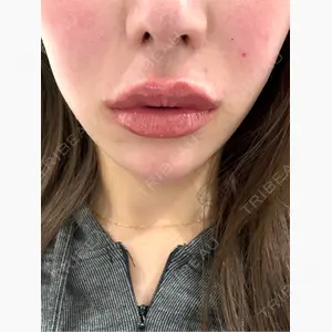 HAAB×DREAM BEAUTY CLINIC 大阪梅田院口コミ