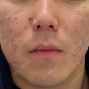 ルラ美容クリニック 広島院口コミ