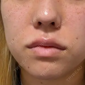 千葉美容外科アイビークリニック口コミ