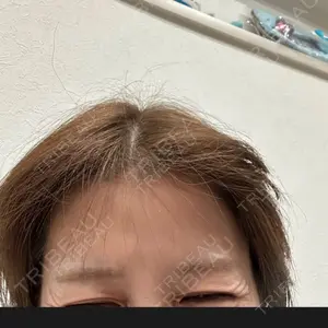 TCB東京中央美容外科 姫路院口コミ