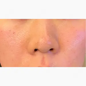 LEX BEAUTY CLINIC口コミ