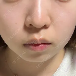 TCB東京中央美容外科 神戸院口コミ