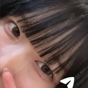 PRO CLINIC プロクリニック 銀座院口コミ