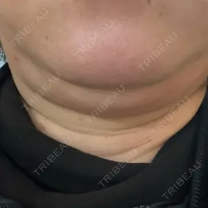 美容皮膚科エルムクリニック 大阪院口コミ