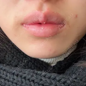 ルラ美容クリニック 神戸院口コミ