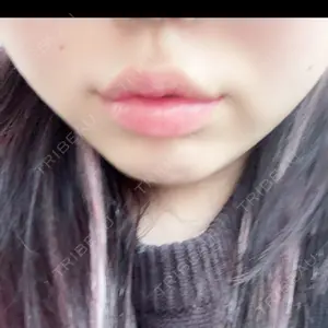 アネシス美容クリニック口コミ