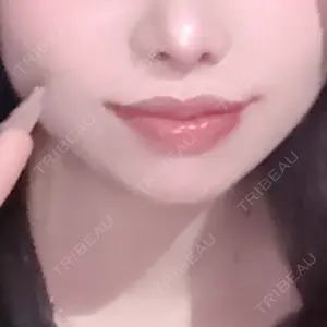 R Beauty CLINIC 名古屋院口コミ