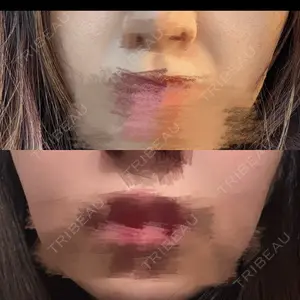 ルラ美容クリニック 渋谷本院口コミ