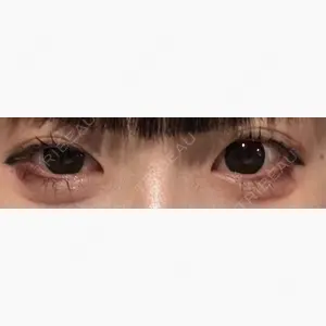 PRO CLINIC プロクリニック 銀座院口コミ