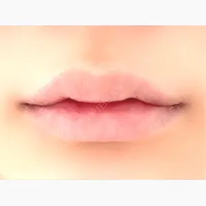 ルラ美容クリニック 新宿院口コミ