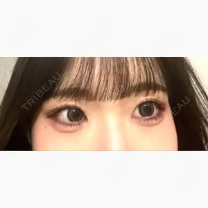 ルラ美容クリニック 上野院口コミ