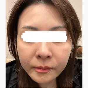 TCB東京中央美容外科 三島院口コミ