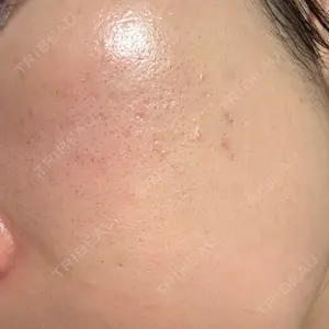 ゆきスキンクリニック 東池袋口コミ