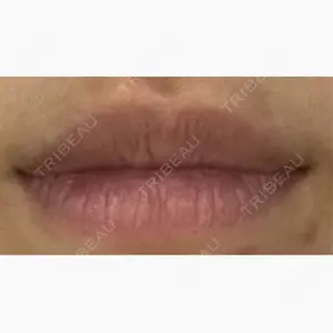 Tokyo Tensei Clinic 新宿院口コミ