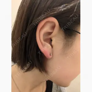 渋谷美容外科クリニック 新宿院口コミ