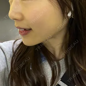 LEX BEAUTY CLINIC口コミ