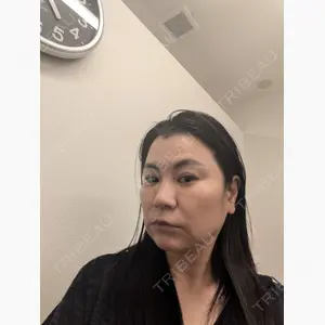 TCB東京中央美容外科 松山院口コミ