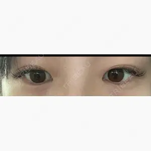 MIYAフェイスクリニック口コミ