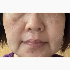 ルラ美容クリニック 池袋院口コミ