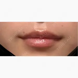 新未来クリニック口コミ