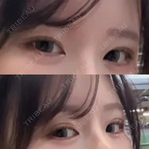 東京シンデレラ美容外科 池袋院口コミ