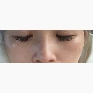 ルラ美容クリニック 仙台院 / ルラスキンクリニック 仙台院口コミ