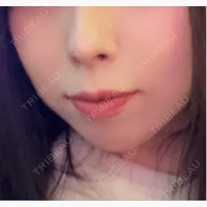 博多美容外科/美容皮膚科 ビラビューティークリニック口コミ