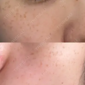 ルラ美容クリニック 札幌本院口コミ