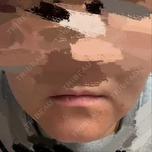 東京形成美容外科 船橋院口コミ