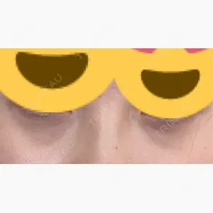 お茶の水美容形成クリニック口コミ