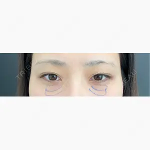 eクリニック 福岡院口コミ