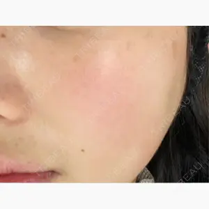 東京シルククリニック 新宿院口コミ