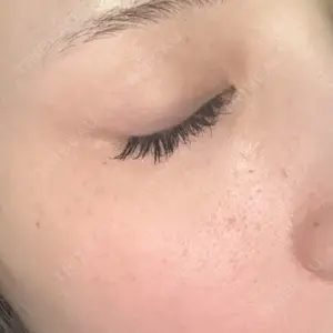 梅田すずらんクリニック口コミ