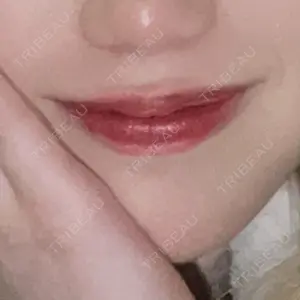 ルラ美容クリニック 大阪本院口コミ