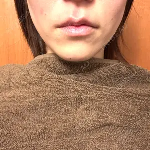 TCB東京中央美容外科 広島院口コミ