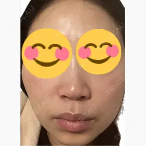 美容皮膚科エルムクリニック 麻布院口コミ