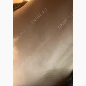 美容皮膚科エルムクリニック 麻布院口コミ