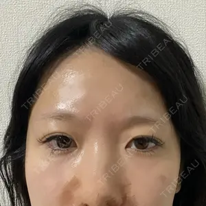 東京シンデレラ美容外科 池袋院口コミ