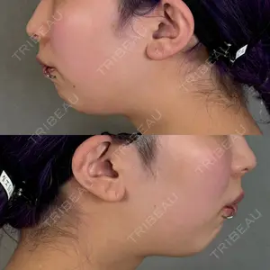 アリエル美容クリニック 大宮院口コミ