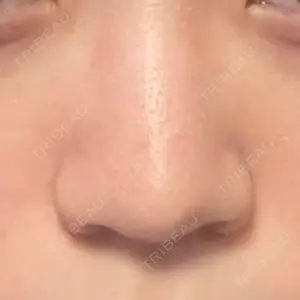 くさのたろうクリニック口コミ