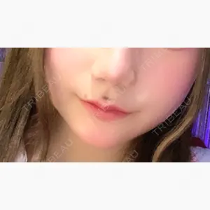 ビューティースキンクリニック 池袋院口コミ