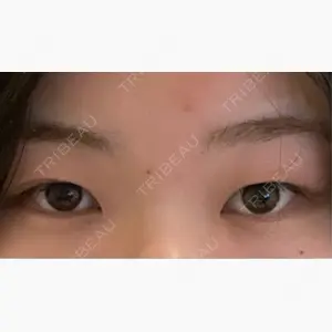 ルラ美容クリニック 大阪心斎橋院口コミ