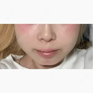 Mirrora CLINIC口コミ