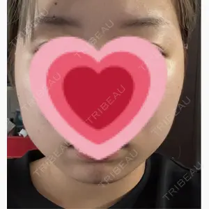 ルラ美容クリニック 札幌大通り院口コミ