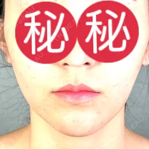 アリエル美容クリニック 郡山院口コミ