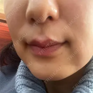 YBC横浜美容外科 立川院口コミ