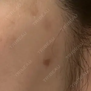 ルラ美容クリニック 東京駅前院口コミ