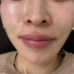 東京シルククリニック 新宿院口コミ